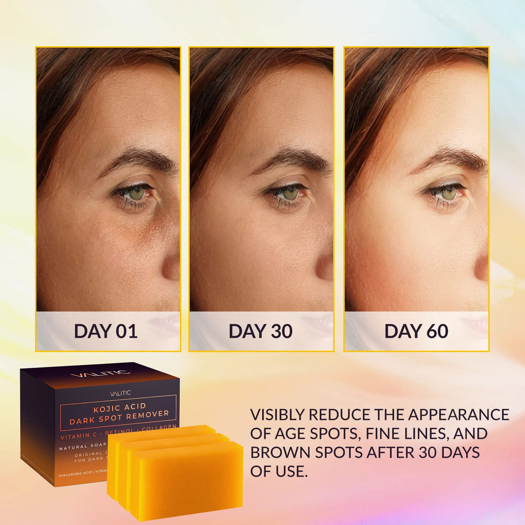 DermaGlow | Kojic Acid Dark Spot Remover Soap