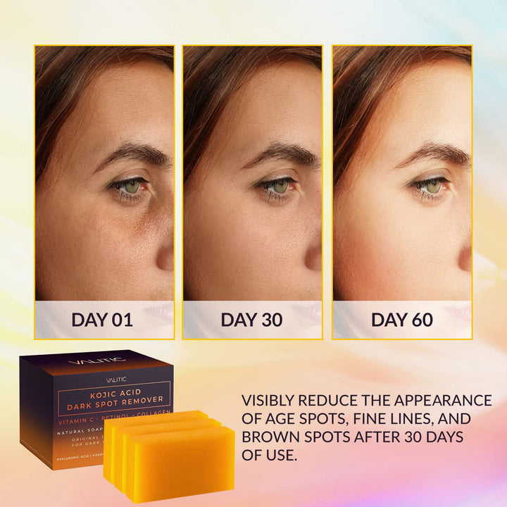 DermaGlow | Kojic Acid Dark Spot Remover Soap