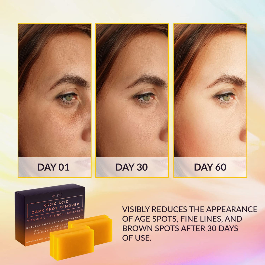 DermaGlow | Kojic Acid Dark Spot Remover Soap