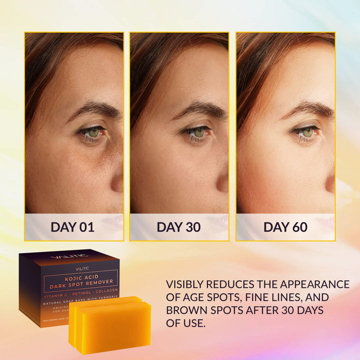 DermaGlow | Kojic Acid Dark Spot Remover Soap