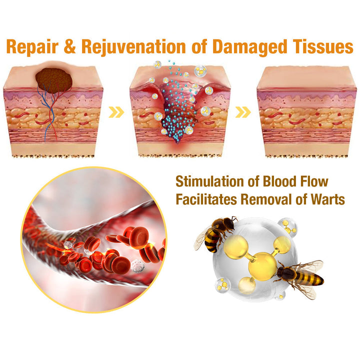 TagAway | Effective removal of warts and skin growths