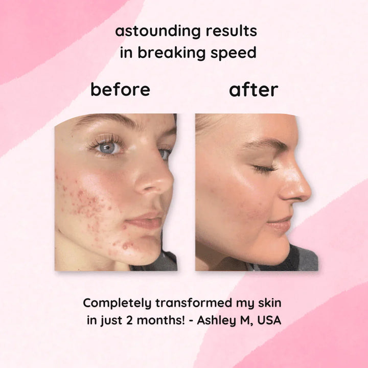 Kojimeric | Brightening Turmeric & Kojic Acid Pads | 40 Pads