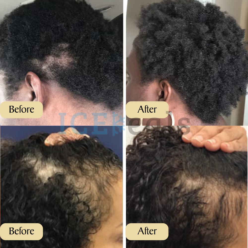 GrowthGlow |  Plant-based formula with 10+ oils for intense hydration and protection