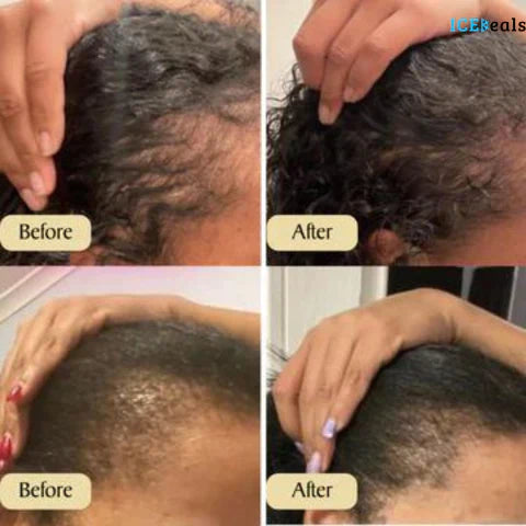 GrowthGlow |  Plant-based formula with 10+ oils for intense hydration and protection
